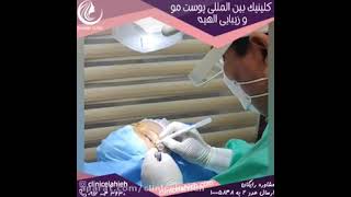 درمان افتادگی پلک با لیزر در تهران