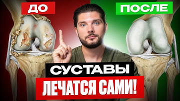 Суставы не "Стерлись"! КАК ИХ ВОССТАНОВИТЬ в домашних условиях?