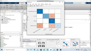 Customized Convolution Neural Network (CNN) image classification MATLAB  code| Covid 19 dataset