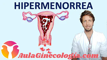 ¿Qué significan las menstruaciones abundantes?