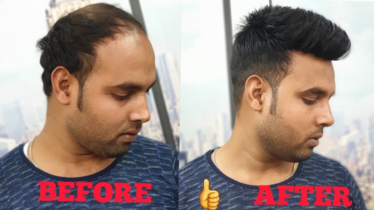 a non surgical hair clipping system [wig] for man in delhi & agra by master  RIZY - YouTube