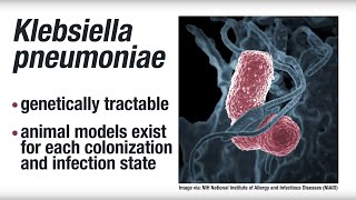 Research: Risk factors for clinical infection with the bacterium Klebsiella pneumoniae