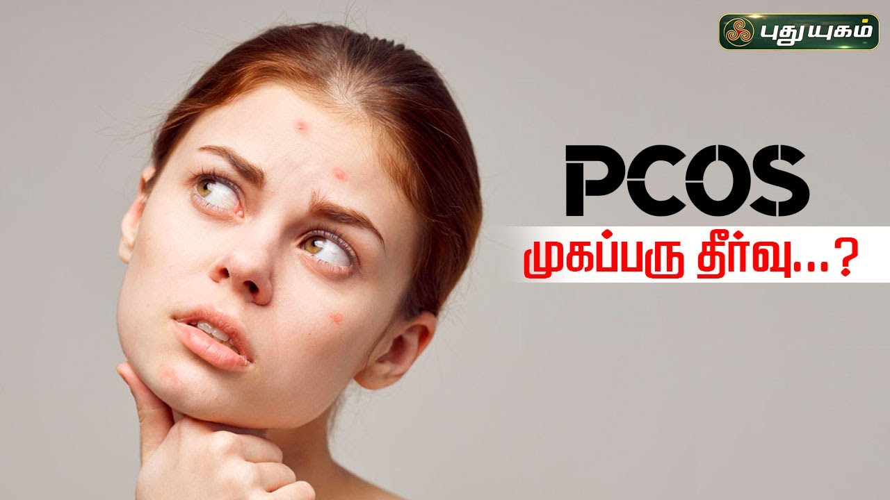 Pcos முகப்பரு தீர்வு...? | Dr. M.S.Usha Nandhini #puthuyugamtv #women #womencare  | 19/07/2024