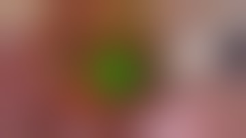 Laparoscopic 4K-ICG Sentinel node, hysterectomy and bilateral adnexectomy in endometrial cancer.