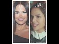 ابطال مسلسل العميل قبل و بعد لايك 