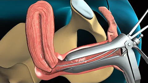 ¿Qué tipo de médico puede realizar una biopsia?