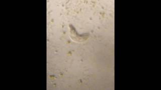 A Holotricha-like ciliate