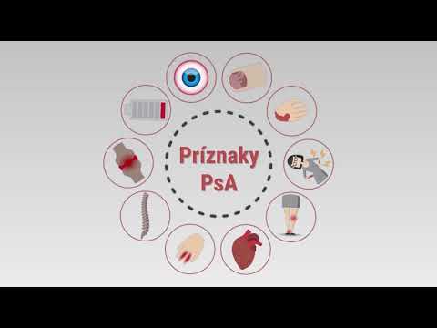 Video: Menopauza A Psoriatická Artritida