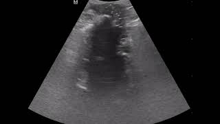 CASE 1035 post partum perineal pain