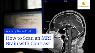 How to Scan an MRI Brain with Contrast