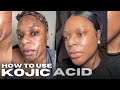 How to use kojic acid soap watch this before using kojic acid