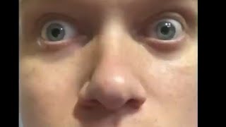 Download Lagu Ultra New Phases For Mr Incredible Becoming Idiot 5 Days Expanded MP3