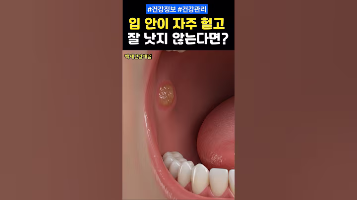 입 안이 자주 헐고 잘 낫지 않는다면? #건강 #건강정보