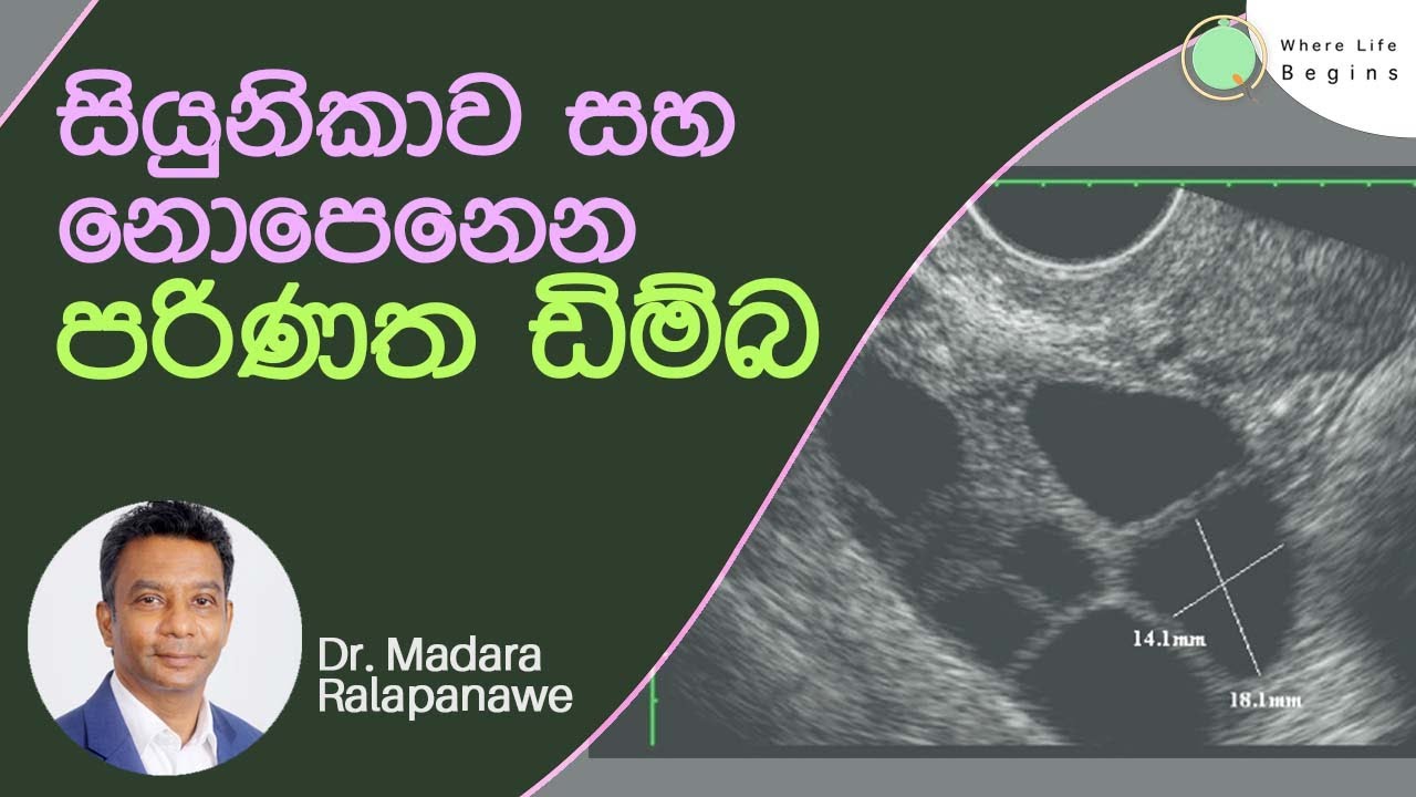 පරිණත ඩිම්බ | Follicles and Mature eggs | Dr Madara Ralapanawe