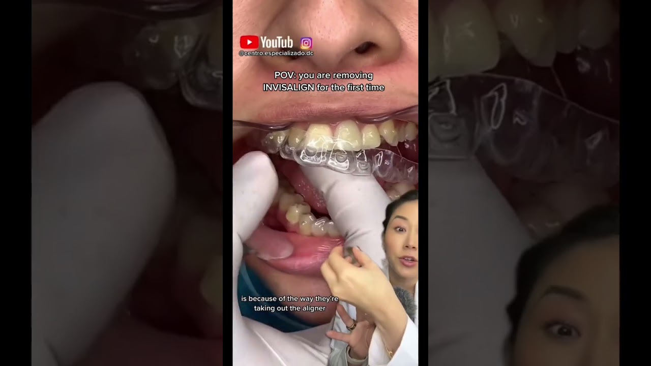 Trick to remove Invisalign. #invisalign #retainers #dentist #braces