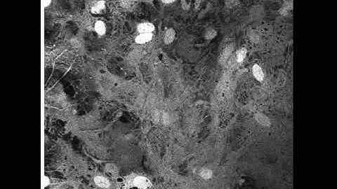 High-magnification video of calcium signaling in astroctyes
