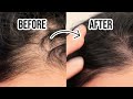 EASY DIY BEAUTY TIPS AND TRICKS : HOW TO COVER WHITE HAIR ROOTS