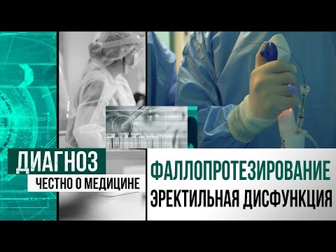 Фаллопротезирование В Москве Цены Отзывы И Фото