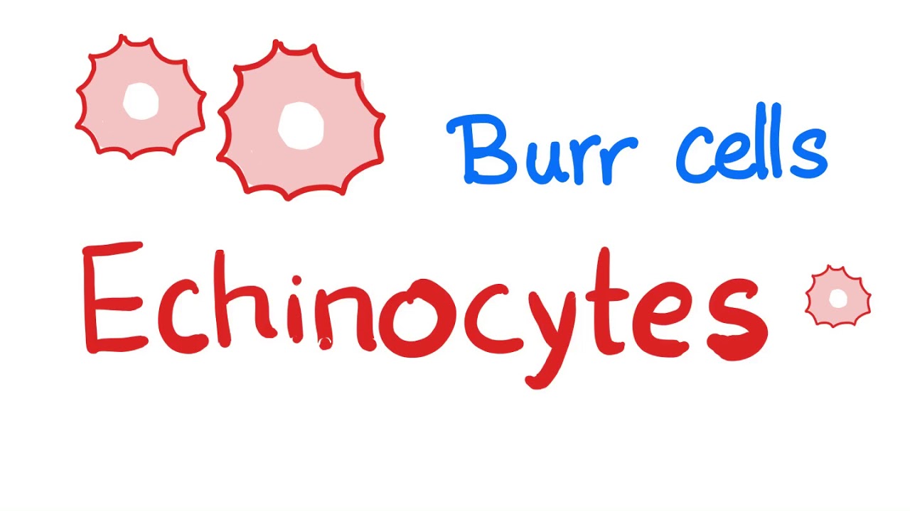 Echinocytes Burr Cells Youtube