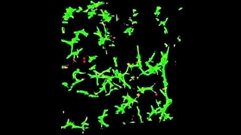 Fibroblasts growing in QGel matrix