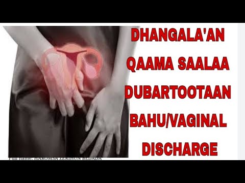 Download Dhangala'a qaama saalaa dubartootaan bahu/Vaginal Discharge