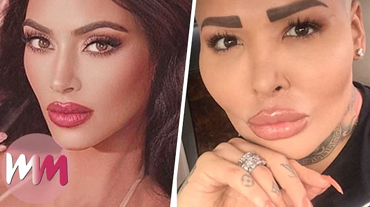 Top 10 People Who Abused Plastic Surgery to Look Like Their Idol - DayDayNews