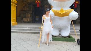 Abby Ooe, The Amputee Girl - Tragedy In The Romantic Town