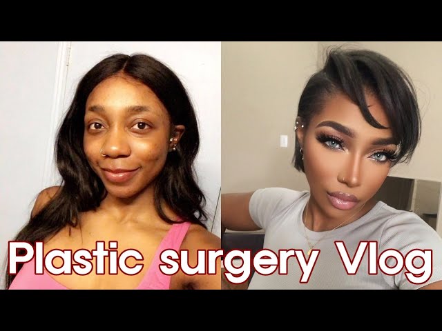 Plastic Surgery In Korea Vlog Part 2, Facial bone surgery&Rhinoplasty