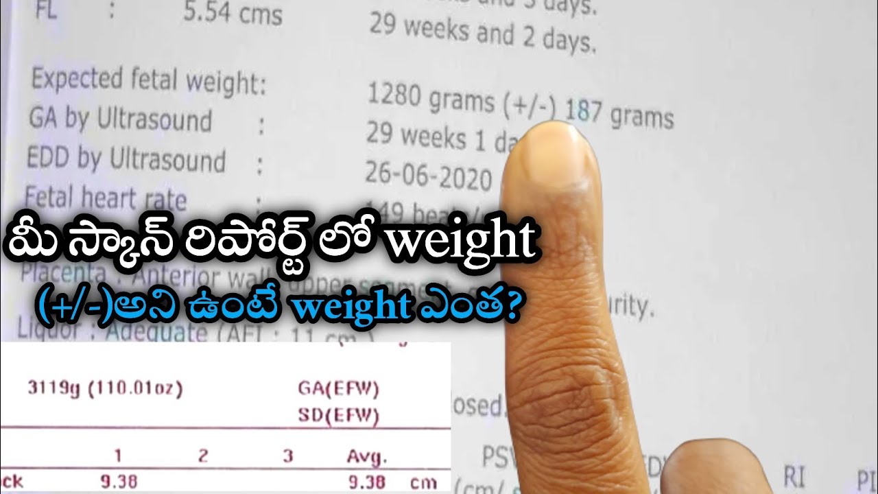 How To Check Baby Weight In Scan Report baby Weight In Scan Report How To Check Baby Weight In Scan Report baby Weight In Scan Report