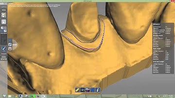 E4D Planmeca COMPARE 2.0