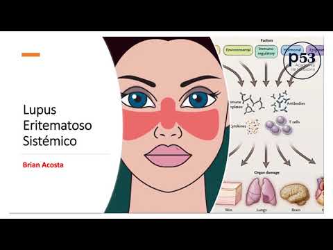 Vídeo: Lupus Eritematoso Sistémico Inducido Por La Terapia Alfa Del Factor De Necrosis Antitumoral: Una Encuesta Nacional Francesa