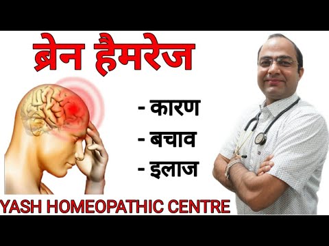 Brain haemorrhage | ब्रेन हेमरेज ।brain stroke best treatment