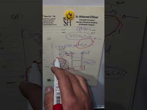 خشونة الركبة الدرجه الثالثة د محمد الشاعر عظام خشونة المفاصل