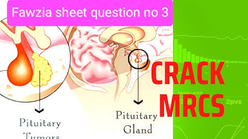 Pituitary tumor Fawzia sheet 03 MRCS question solve (CRACK MRCS)