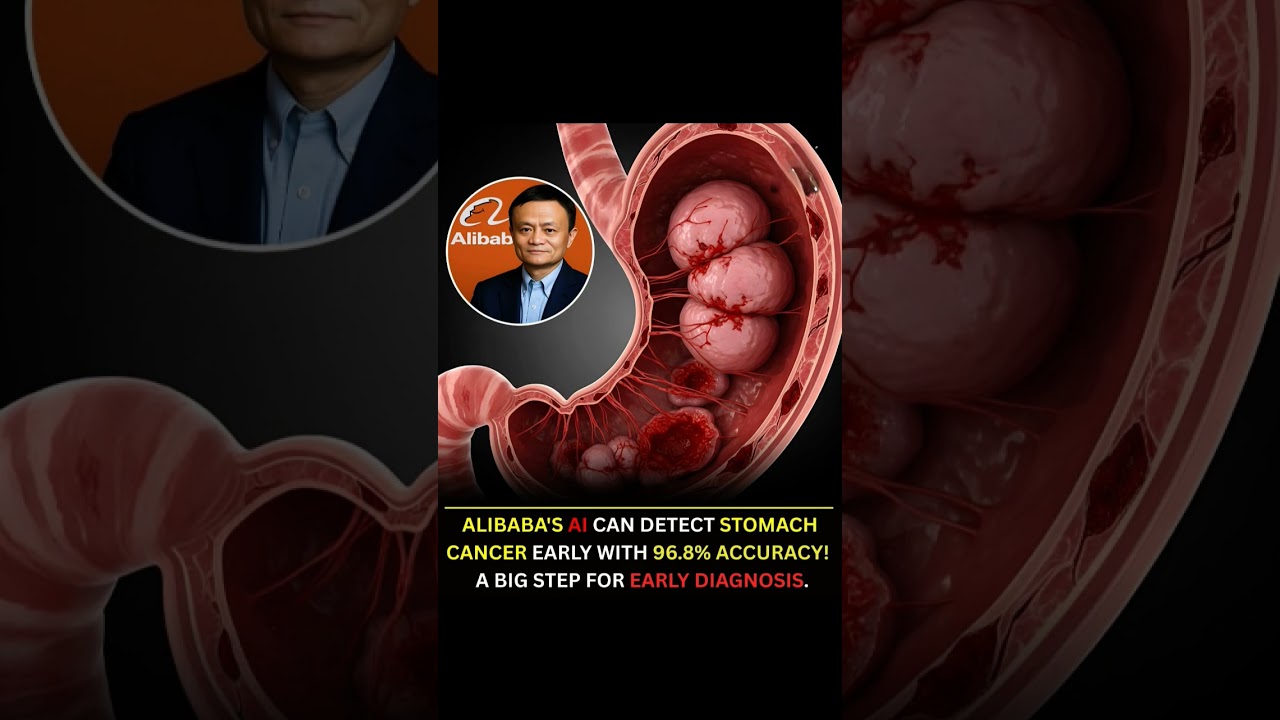 Alibaba’s AI Detects Stomach Cancer Without Endoscopy! 😱🩻 