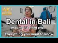 Dental in bali 13 of the cost to most countries  is it worth it  we  show you start to finish