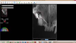 CDR software tutorial for vets