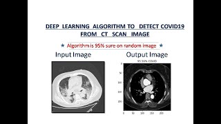 Detect COVID19 from chest CT-scan. Deep Learning algorithm to detect corona from chest CT images. screenshot 4