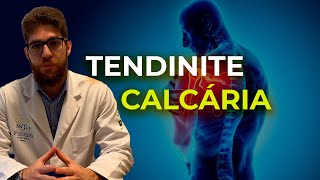 MELHORE DA TENDINITE CALCÁRIA - DOR NO OMBRO MELHORE DA TENDINITE CALCÁRIA - DOR NO OMBRO