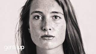 Síndrome de BOCA SECA o Xerostomía. Causas y Tratamiento