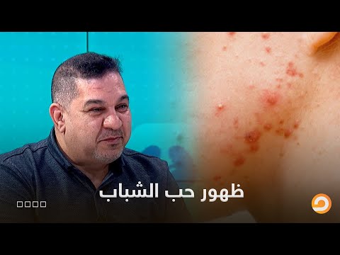 لو بيظهرلك حبوب باستمرار ومش عارف تعمل ايه شوف الفيديو دا
