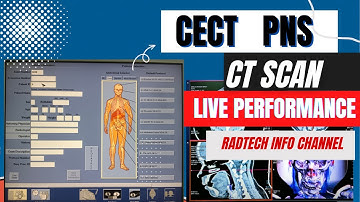 Live pns paranasal sinusitis ct scan with contrast GE Machine Learning purposes #pns #ge #live