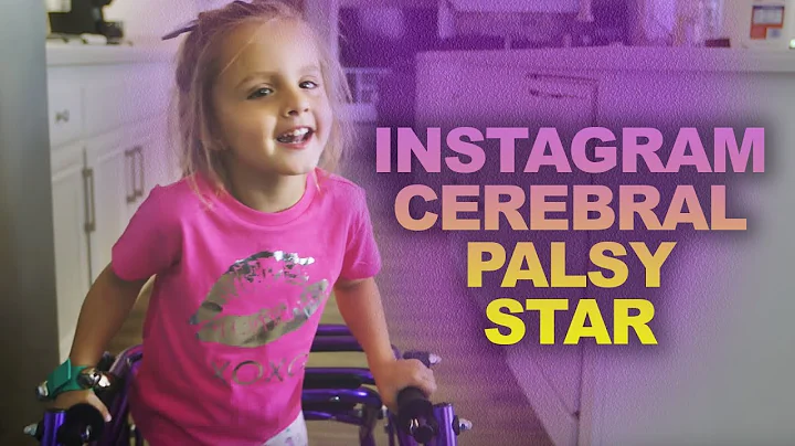 Instagram Cerebral Palsy Child Star | Living Differently - DayDayNews