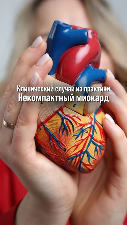 🫀 Некомпактный миокард или...? Неожиданный диагноз у молодой пациентки ...