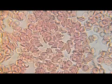 Αίμα στο μικροσκόπιο - Μεγέθυνση 1000x (HD 1080p)