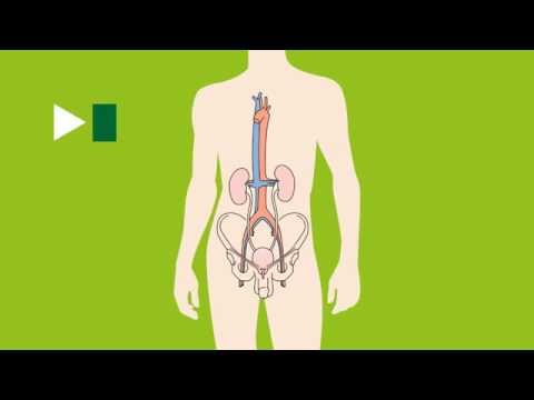 Karcinom varlat - Určení rozsahu nádoru (staging)