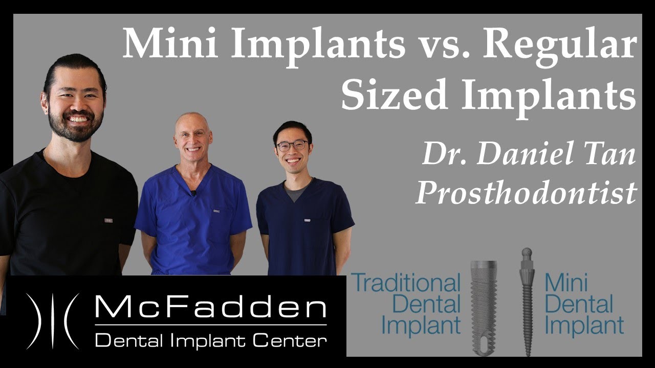 Mini Implants vs Regular Implants