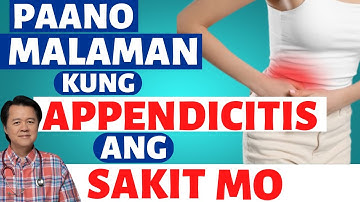 Paano Malaman Kung Appendicitis ang Sakit Mo? - By Doc Willie Ong (Internist and Cardiologist)