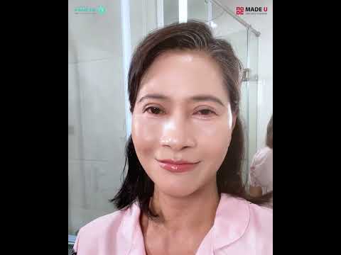 Trẻ ra cả