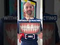 Adult Invisalign case review for crooked teeth that stick out. ￼
